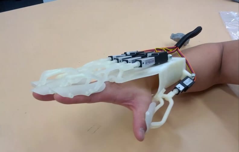 Hand orthosis prototype in use