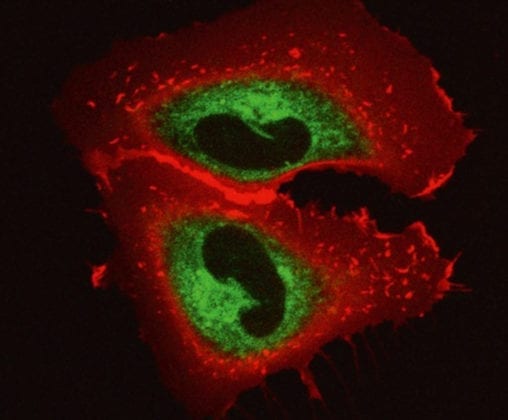 Two merged cells with red and green staining from an imaging agent. 