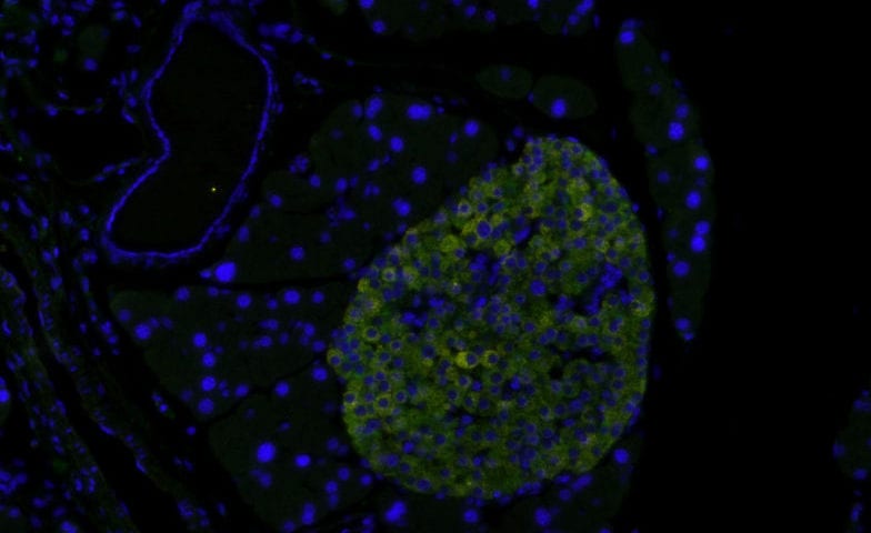A flourescent microscopic image of a mouse pancreas