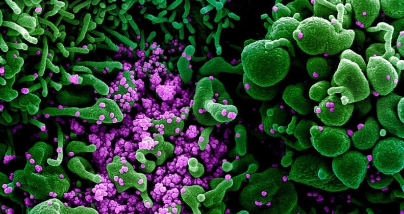 A colourised electron micrograph of a cell heavily infected with COVID-19 particles. Image credit: National Institute of Allergy and Infectious Diseases, US.