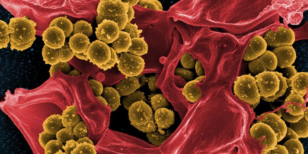 Image for How do superbugs become super? Understanding antibiotic resistance
