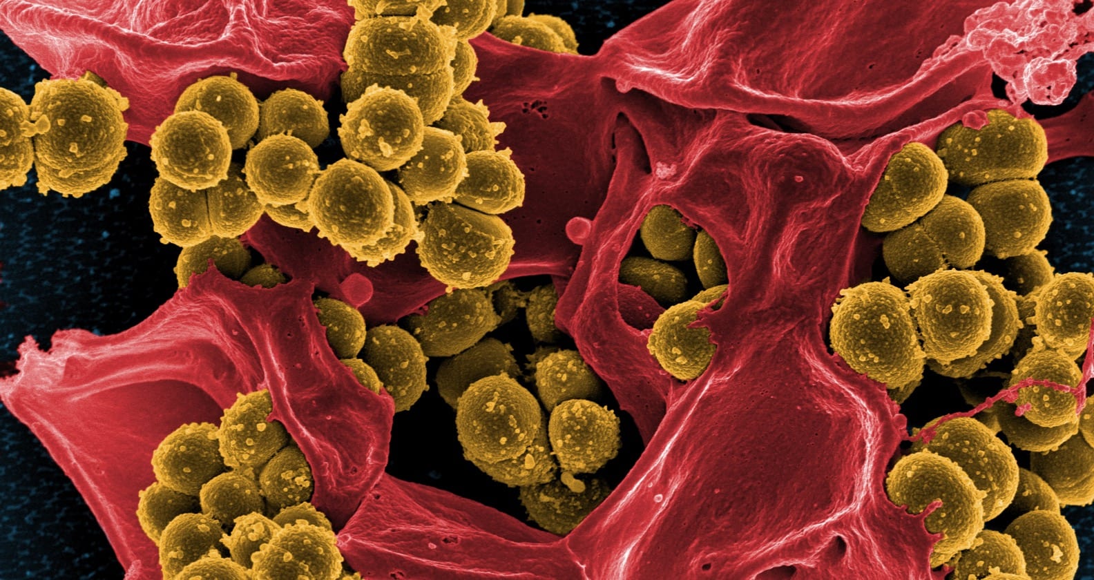 Image for How do superbugs become super? Understanding antibiotic resistance