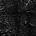 Measuring leakage through the blood-brain barrier