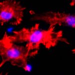 Keeping cancer in check: the potential of checkpoint blockade to treat elderly cancer patients