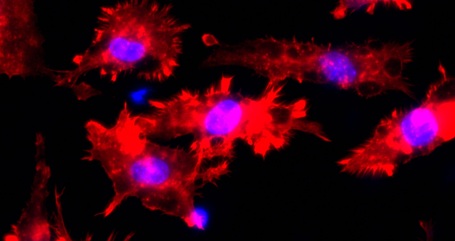 Image for Keeping cancer in check: the potential of checkpoint blockade to treat elderly cancer patients