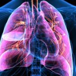 Funding boost gives hope to vulnerable Australian cardiac patients