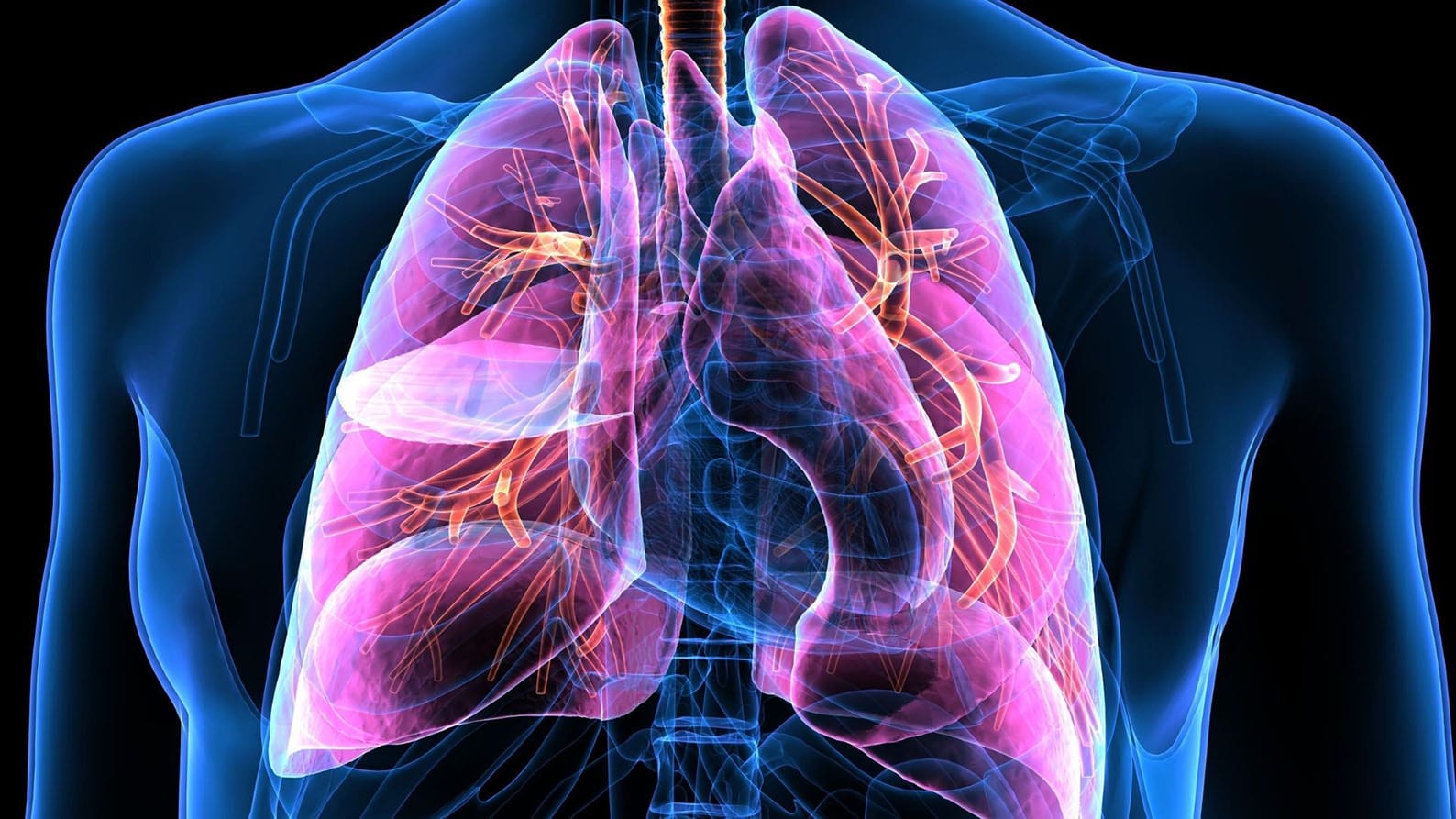 Image for Funding boost gives hope to vulnerable Australian cardiac patients