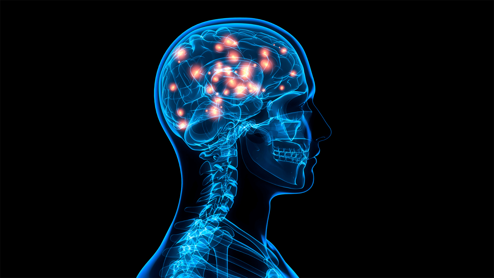 Image for Curtin neurological disease research awarded MSWA funding boost