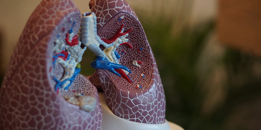 Image for New study highlights major deficiencies in lung cancer care in Australia