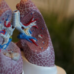 New study highlights major deficiencies in lung cancer care in Australia