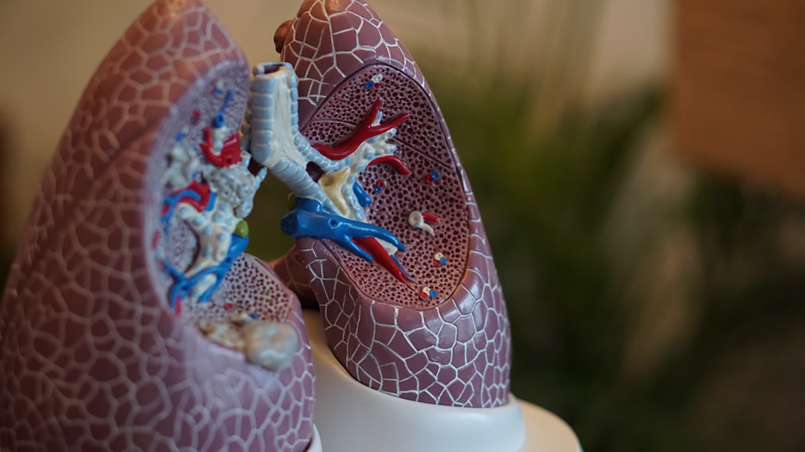 Image for New study highlights major deficiencies in lung cancer care in Australia