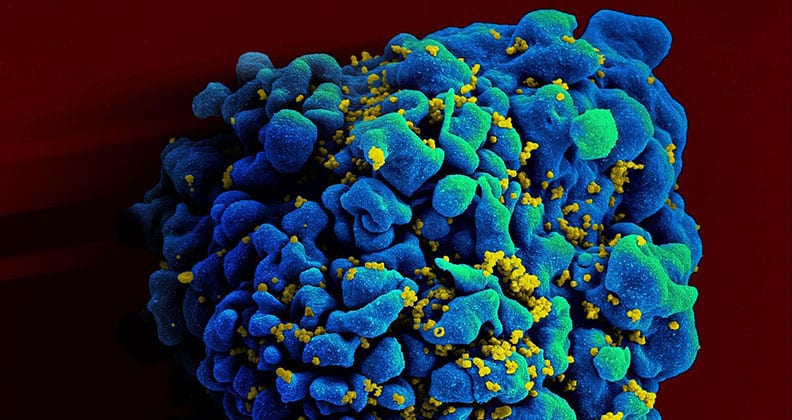 Image for Research recommends home HIV tests in Australia
