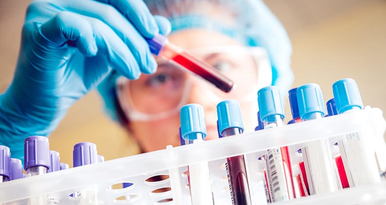 New blood cancer study: Burden of Myeloproliferative Neoplasms in Australia revealed