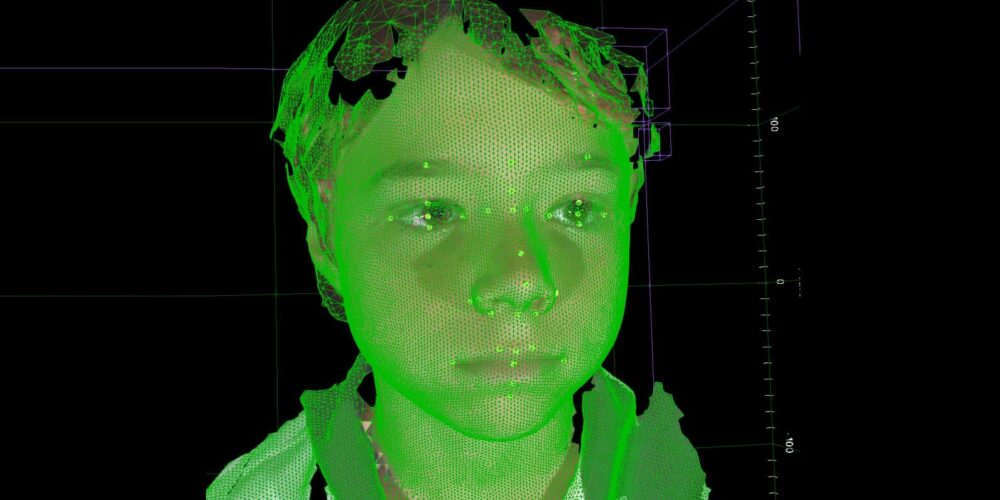 Image for 3D technology finds tiny medical clues in children’s faces