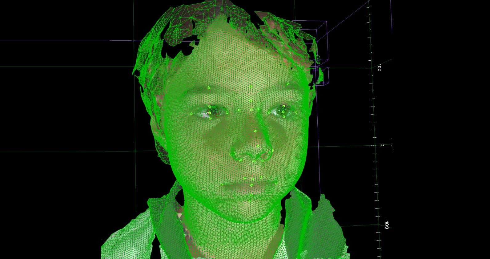 Image for 3D technology finds tiny medical clues in children’s faces