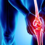 Greater support needed to improve the treatment of knee osteoarthritis