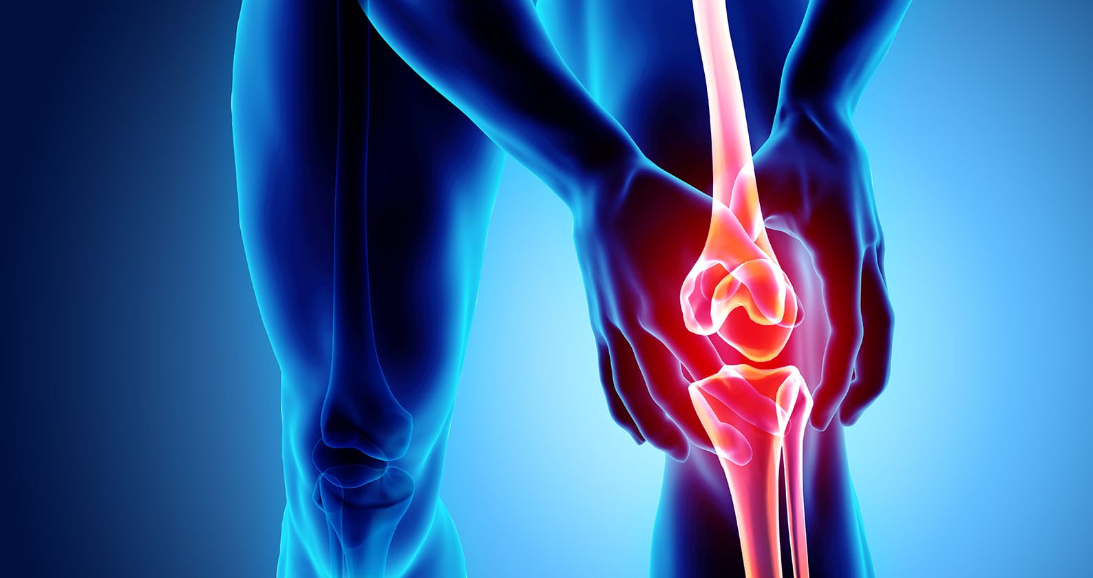 Image for Greater support needed to improve the treatment of knee osteoarthritis