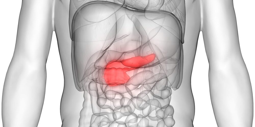 Image for Curtin study investigates potential new treatments for pancreatic cancer