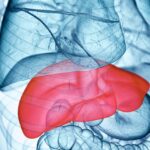 Curtin’s plan to combat chronic liver disease and cancer