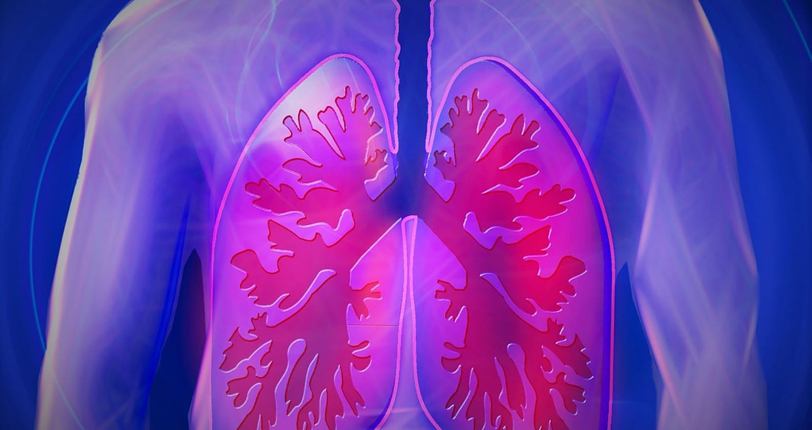 Image for Common asbestos lung disease does not increase risk of lung cancer