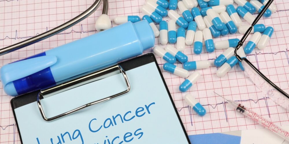 Major gaps in lung cancer services across Australia and New Zealand: study