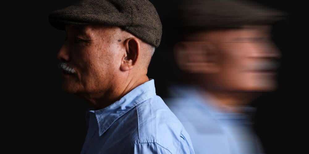 Common gene variant doubles dementia risk for men
