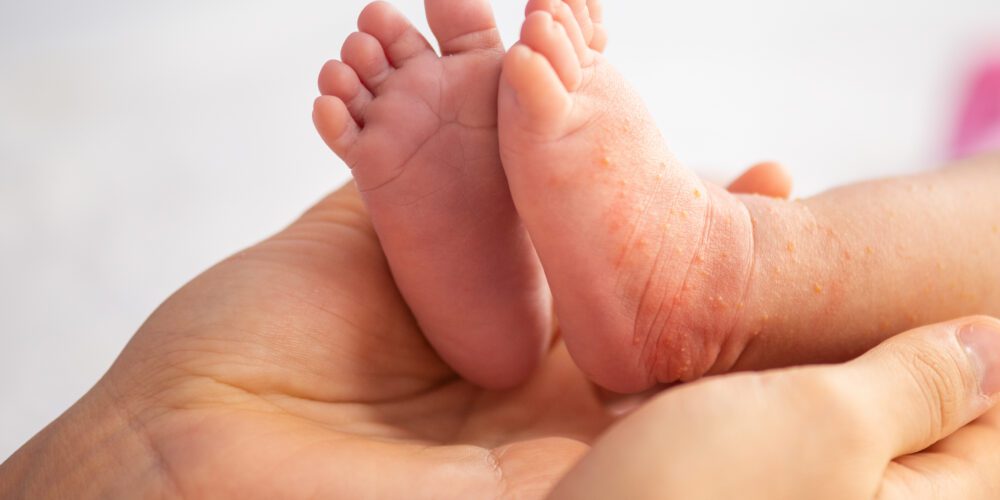 Image for Research reveals many newborn baby deaths linked to preventable or treatable factors
